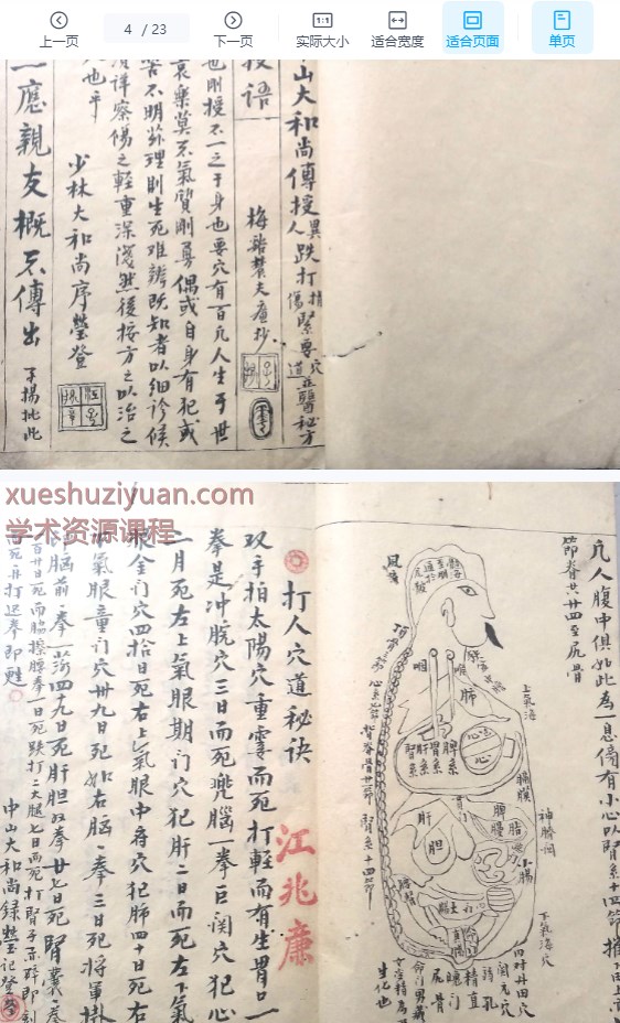 2509154 古籍少林中山大和尚传授《遗传外科》抄本23双面Y插图1